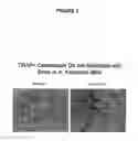 Fig. 03 - Methods for inhibiting osteoclast differentiation, formation, or function and for increasing bone mass