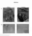 Fig. 10 - Methods for inhibiting osteoclast differentiation, formation, or function and for increasing bone mass