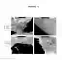 Fig. 11 - Methods for inhibiting osteoclast differentiation, formation, or function and for increasing bone mass