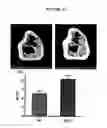 Fig. 12 - Methods for inhibiting osteoclast differentiation, formation, or function and for increasing bone mass