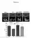 Fig. 13 - Methods for inhibiting osteoclast differentiation, formation, or function and for increasing bone mass