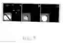Fig. 10 - Gene silencing by systemic rna interference