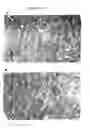 Fig. 29 - Methods for treatment or prophylaxis of aldosterone-mediated pathogenic effects in a subject using an epoxy-steroidal aldosterone antagonist
