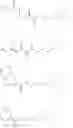 Fig. 182 - Novel piperidine derivative for the treatment of depression