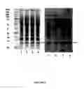 Fig. 06 - Method for the treatment of a ubiquitin conjugating disorder