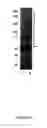 Fig. 07 - Method for the treatment of a ubiquitin conjugating disorder
