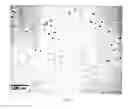Fig. 07 - Method for crystallization of proteins using polysaccharides