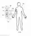Fig. 07 - Magnetic therapeutic wand, apparatus and method