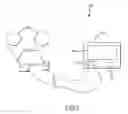Fig. 03 - INTRA-OPERATIVE OCULAR PARAMETER SENSING