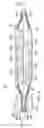 Fig. 03 - SELF-FOLDING PADDLE LEAD AND METHOD OF FABRICATING A PADDLE LEAD