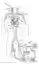 Fig. 01 - Surgical system and procedure for treatment of medically refractory atrial fibrillation
