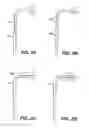 Fig. 07 - Surgical system and procedure for treatment of medically refractory atrial fibrillation