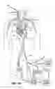 Fig. 09 - Surgical system and procedure for treatment of medically refractory atrial fibrillation