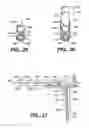 Fig. 33 - Surgical system and procedure for treatment of medically refractory atrial fibrillation