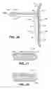 Fig. 35 - Surgical system and procedure for treatment of medically refractory atrial fibrillation