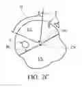Fig. 05 - Image analysis methods for gleno-humeral joint morphology