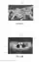 Fig. 08 - Image analysis methods for gleno-humeral joint morphology