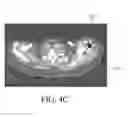 Fig. 09 - Image analysis methods for gleno-humeral joint morphology