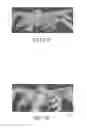 Fig. 10 - Image analysis methods for gleno-humeral joint morphology