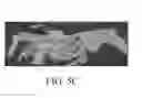 Fig. 11 - Image analysis methods for gleno-humeral joint morphology