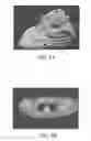 Fig. 12 - Image analysis methods for gleno-humeral joint morphology