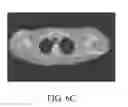 Fig. 13 - Image analysis methods for gleno-humeral joint morphology
