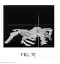 Fig. 15 - Image analysis methods for gleno-humeral joint morphology