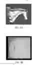 Fig. 16 - Image analysis methods for gleno-humeral joint morphology