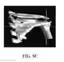 Fig. 17 - Image analysis methods for gleno-humeral joint morphology