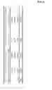 Fig. 06 - Apparatus for analyzing a sleep structure according to non-constrained weight detection