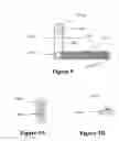 Fig. 08 - Daneshvar wrapping means II and methods