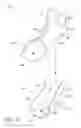 Fig. 11 - Foot orthosis support device method and apparatus