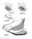 Fig. 07 - Orthopedic braces and casts with aerating arrangements