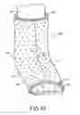 Fig. 08 - Orthopedic braces and casts with aerating arrangements