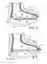 Fig. 10 - Orthopedic braces and casts with aerating arrangements