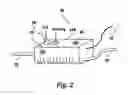 Fig. 03 - Device for improved visualization of operative sites during surgery