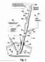 Fig. 07 - Device for improved visualization of operative sites during surgery