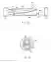Fig. 10 - Bifurcated Catheter Joints