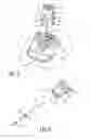 Fig. 03 - Low profile infusion set