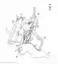 Fig. 07 - Apparatus and method for injection of fibrin sealant in spinal applications