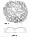 Fig. 06 - Absorbent article having stain resistant properties