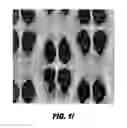 Fig. 09 - Absorbent article having stain resistant properties