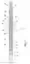 Fig. 07 - Detachable cryosurgical probe