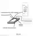 Fig. 15 - Electrosurgical methods and devices employing phase-controlled radiofrequency energy
