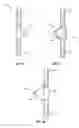 Fig. 10 - Vertebral rods and methods of use