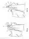 Fig. 02 - Non-locking multi-axial joints in a vertebral implant and methods of use