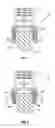 Fig. 05 - Non-locking multi-axial joints in a vertebral implant and methods of use