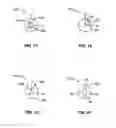 Fig. 05 - Spinal rods having different flexural rigidities about different axes and methods of use