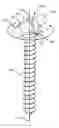 Fig. 01 - Devices and methods for attaching a rod to a vertebral member