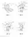 Fig. 06 - Devices and methods for attaching a rod to a vertebral member
